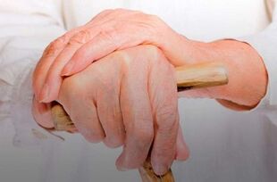 Πόνος στις αρθρώσεις των δακτύλων με ρευματοειδή αρθρίτιδα